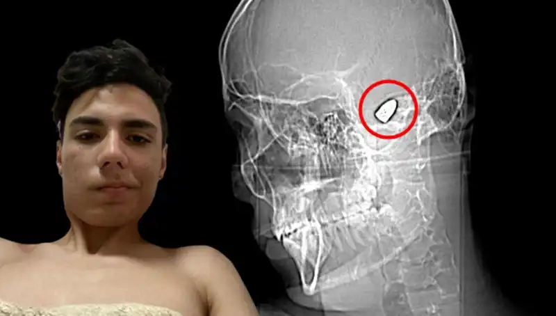 Kafasında Patlayan Bomba Korkusu: Akıl Sağlığı Üzerindeki Etkileri